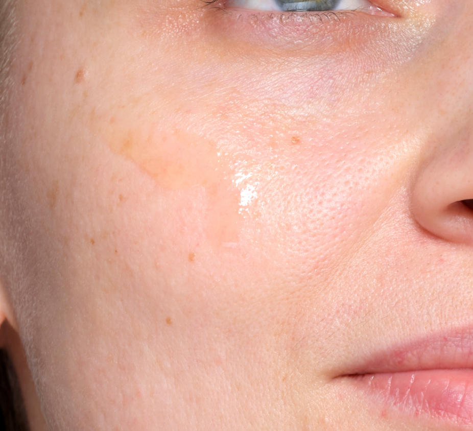 Radiance & Pigmentation Spots